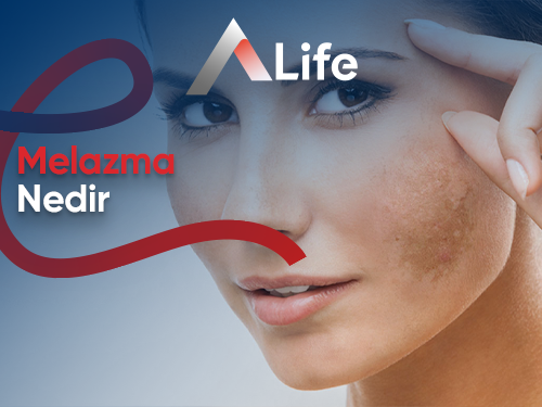 Melazma Nedir? Melazma Lekeleri Neden Oluşur?